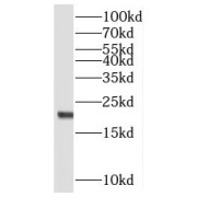 WB analysis of Jurkat cells, using MRPL48 antibody (1/800 dilution).