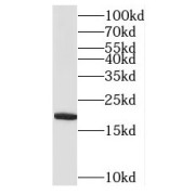 WB analysis of human liver tissue, using MRPL52 antibody (1/300 dilution).