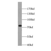 WB analysis of HeLa cells, using MTA2 antibody (1/1000 dilution).