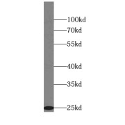 WB analysis of HepG2 cells, using COX2 antibody (1/1000 dilution).
