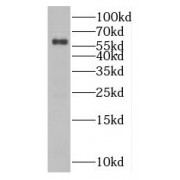 WB analysis of Jurkat cells, using MTF2 antibody (1/600 dilution).