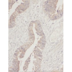 Monofunctional C1-Tetrahydrofolate Synthase, Mitochondrial (MTHFD1L) Antibody