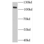 WB analysis of HepG2 cells, using MTHFD1L antibody (1/500 dilution).