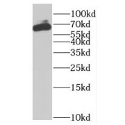 WB analysis of L02 cells, using MTM1 antibody (1/1000 dilution).