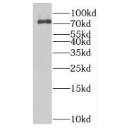 WB analysis of K-562 cells, using MTMR12 antibody (1/1500 dilution).