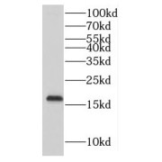 WB analysis of mouse skeletal muscle tissue, using MTP18 antibody (1/300 dilution).