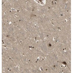 Myotrophin (MTPN) Antibody