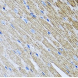 Metaxin 2 (MTX2) Antibody