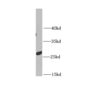 WB analysis of mouse heart tissue, using MTX2 antibody (1/600 dilution).