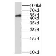 WB analysis of mouse heart tissue, using MURC antibody (1/600 dilution).