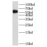 WB analysis of HeLa cells, using MUTYH antibody (1/500 dilution).