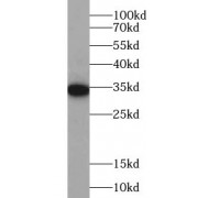 WB analysis of Myc-tagged fusion protein, using MYC tag antibody (1/10000 dilution).