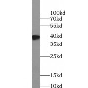 WB analysis of Myc-tagged fusion protein, using MYC tag antibody (1/4000 dilution).
