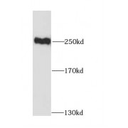 WB analysis of mouse brain tissue, using MYH10 antibody (1/1000 dilution).