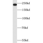 WB analysis of COLO 320 cells, using MYH14 antibody (1/800 dilution).