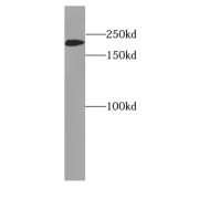 WB analysis of LO2 cells, using MYH2 antibody (1/500 dilution).