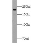 WB analysis of mouse heart tissue, using MYH7 antibody (1/1000 dilution).