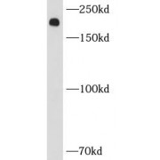 WB analysis of mouse kidney tissue, using MYH9 antibody (1/1000 dilution).
