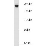WB analysis of HL-60 cells, using Myh9 antibody (1/500 dilution).