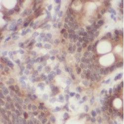 Myosin Light Chain Kinase 3 (MYLK3) Antibody