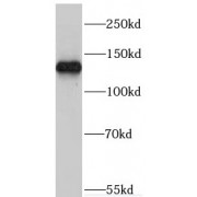 WB analysis of mouse brain tissue, using MYO1A antibody (1/500 dilution).