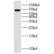 WB analysis of human heart tissue, using Myocilin antibody (1/300 dilution).