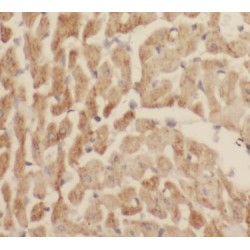 Myoglobin (MB) Antibody