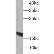 WB analysis of mouse skeletal muscle tissue, using MB antibody (1/1000 dilution).