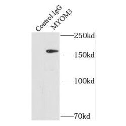 Myomesin 3 (MYOM3) Antibody