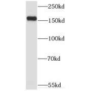 WB analysis of mouse skeletal muscle tissue, using MYOM3 antibody (1/500 dilution).