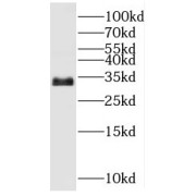 WB analysis of mouse heart tissue, using Myozenin 2 antibody (1/4000 dilution).