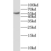 WB analysis of human heart tissue, using NAB2 antibody (1/500 dilution).
