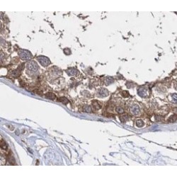 Nanos C2HC-Type Zinc Finger 3 (NANOS3) Antibody