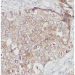 N-Acetyltransferase 1 (NAT1) Antibody
