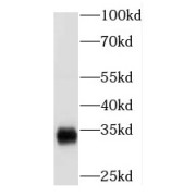 WB analysis of A375 cells, using NAT1 antibody (1/300 dilution).