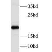 WB analysis of K-562 cells, using NAT13 antibody (1/300 dilution).