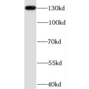WB analysis of mouse brain tissue, using N-cadherin antibody (1/2000 dilution).