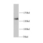WB analysis of mouse brain tissue, using NCAM1 antibody (1/1000 dilution).