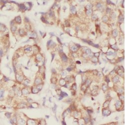 Non Catalytic Region of Tyrosine Kinase Adaptor Protein 1 (NCK1) Antibody