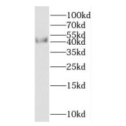 WB analysis of mouse brain tissue, using NCK1 antibody (1/400 dilution).