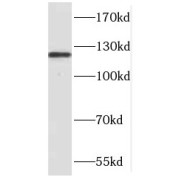 abx235585