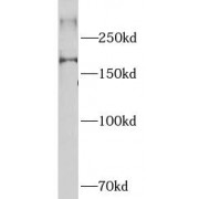 WB analysis of HeLa cells, using NCOR2 antibody (1/1000 dilution).