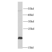 WB analysis of HeLa cells, using NCS1 antibody (1/1000 dilution).