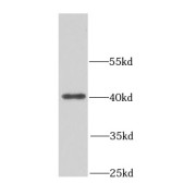 WB analysis of A2780 cells, using NDE1 antibody (1/1500 dilution).