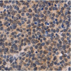 NADPH-Dependent Diflavin Oxidoreductase 1 (NDOR1) Antibody