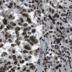 NADH Ubiquinone Oxidoreductase Subunit B5 (NDUFB5) Antibody
