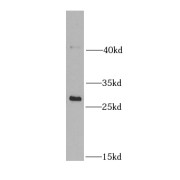 WB analysis of human heart tissue, using NDUFS3 antibody (1/1000 dilution).