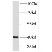 WB analysis of human brain tissue, using NECAP1 antibody (1/500 dilution).