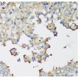 E3 Ubiquitin-Protein Ligase NEDD4-Like (NEDD4L) Antibody