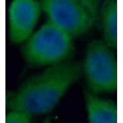 Serine, Threonine-Protein Kinase Nek2 (NEK2) Antibody